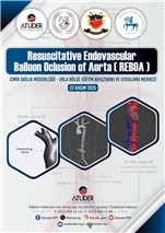 Resuscitative Endovascular Ballon Oclusion of Aorta (REBOA)